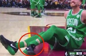 NBA球员的5大烦恼：詹姆斯穿最好的球鞋，却避免不了脚趾变形